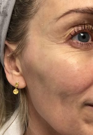 test-dermalogica-efterbillede